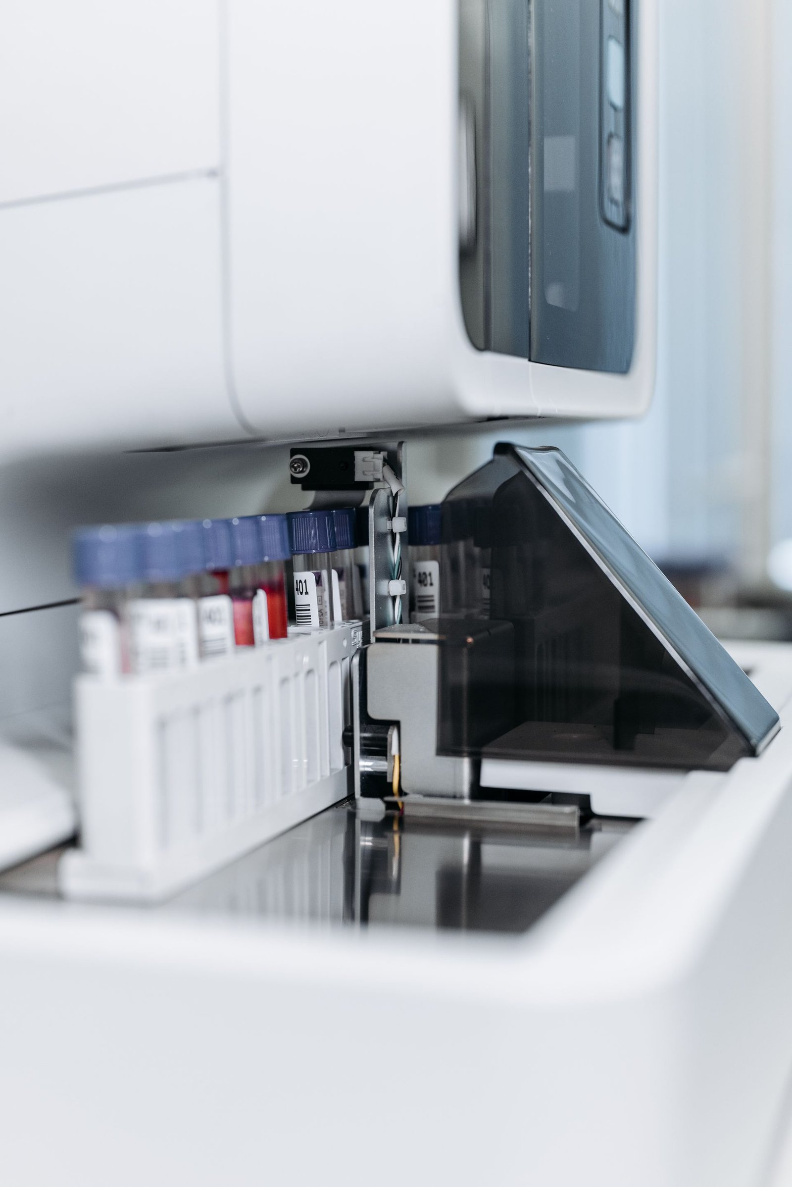 Test tubes in medical equipment (stock photo, illustrative)
